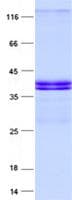 Human IMP4 Protein (Recombinant His, N-Terminal)