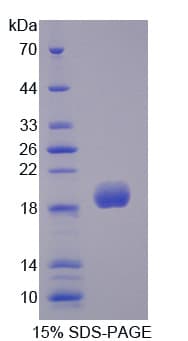 Rat SOD3 Protein (Recombinant His)