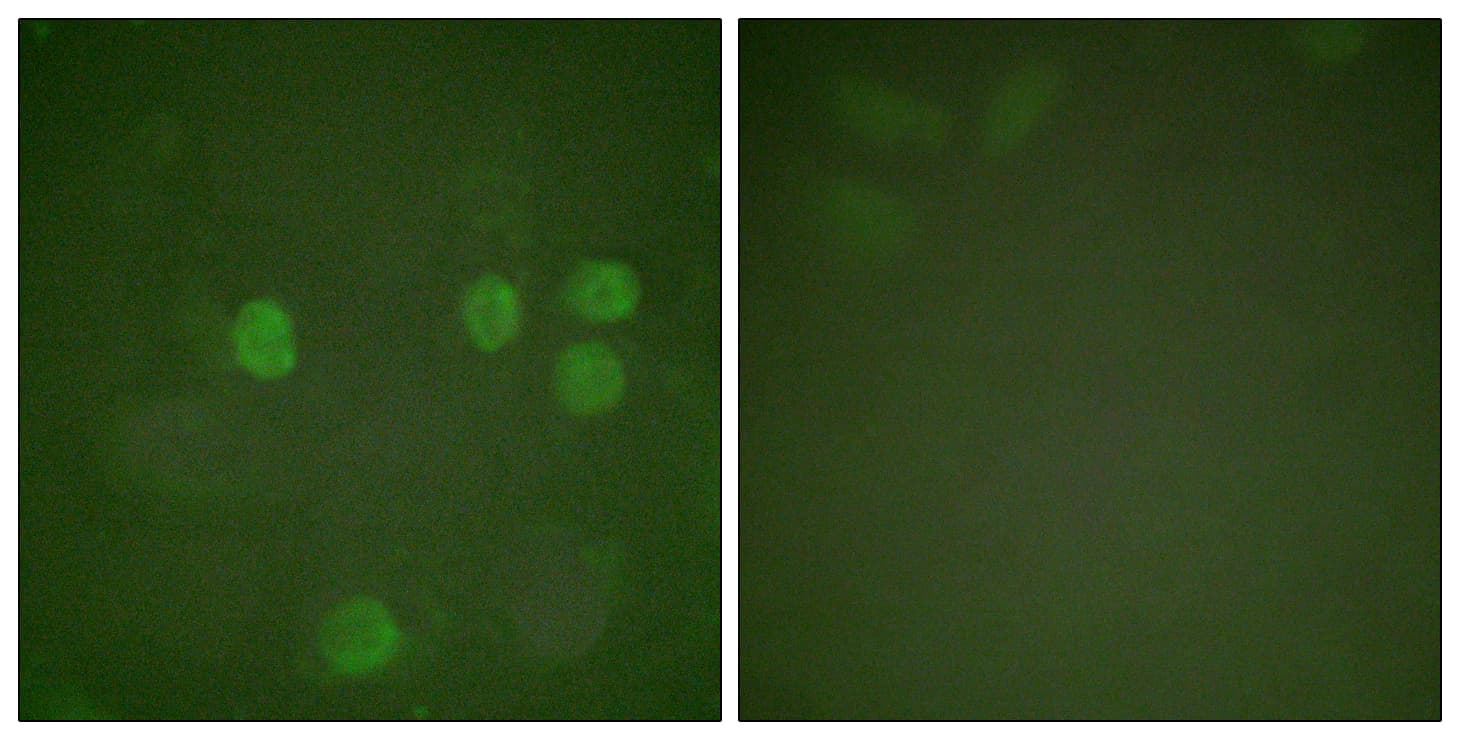 CCNB1 / Cyclin B1 Antibody (aa91-140)