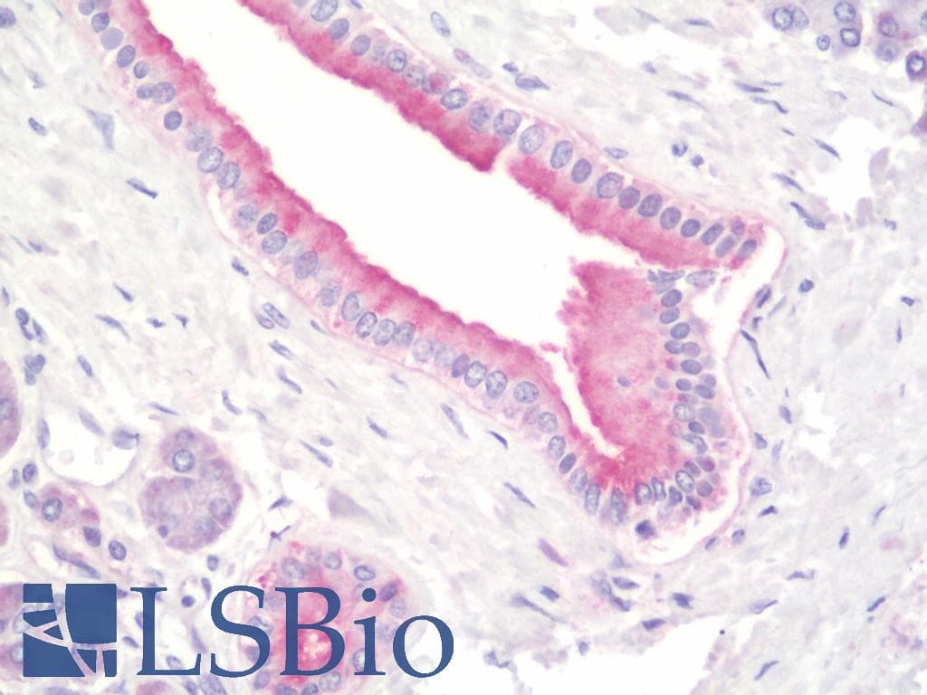IHC-plus™ PFDN5 / MM1 Antibody