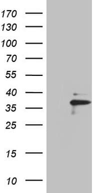 EBLN2 / FLJ10213 Antibody (clone OTI3E1)