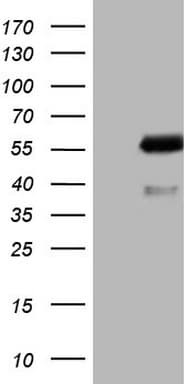 AKT1 Antibody (clone OTI1B2, Carrier-free)
