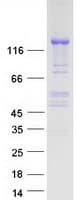Human CDAN1 Protein (Recombinant Myc-DDK (Flag))