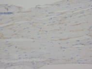 CRP / C-Reactive Protein Antibody (N-Terminus, Sepharose)