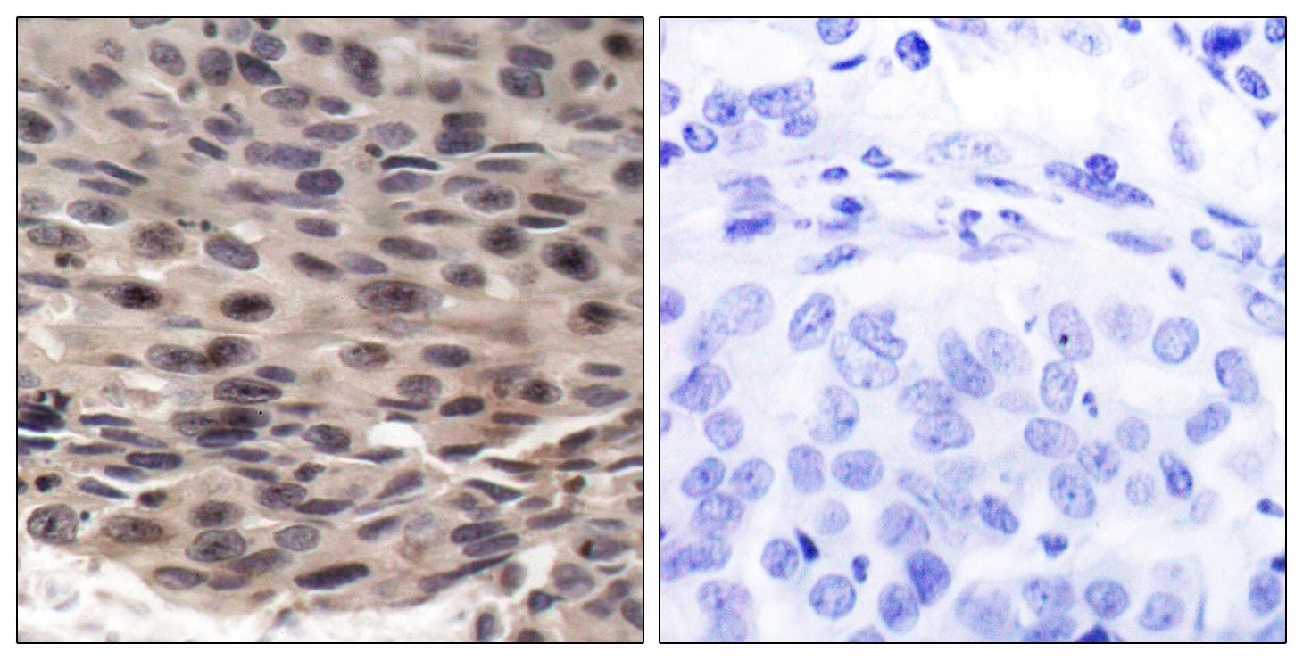 EIF4EBP1 / 4EBP1 Antibody (phospho-Thr36)