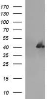 Monoclonal Mouse anti-Human SERPINB3 Antibody (clone OTI1A10, WB)