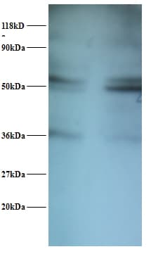 SARS / Serine-tRNA Ligase Antibody