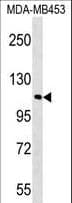 FAM65B / DIFF48 Antibody (aa829-856)