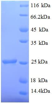 Rat TIMP1 Protein (Recombinant His)