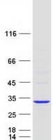 Human ETFB Protein (Recombinant Myc-DDK (Flag))