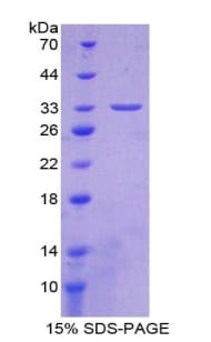 Mouse BRCA1 Protein (Recombinant His-T7)