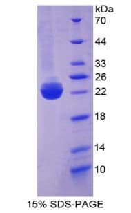 Rat BMP3 Protein (Recombinant His-T7)