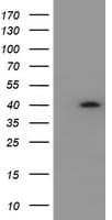 HSD17B2 Antibody (clone OTI4F10)