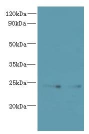 TMED2 Antibody