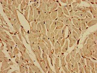IREB2 / IRP2 Antibody