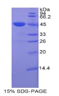 Mouse CDNF / ARMETL1 Protein (Recombinant His-GST)