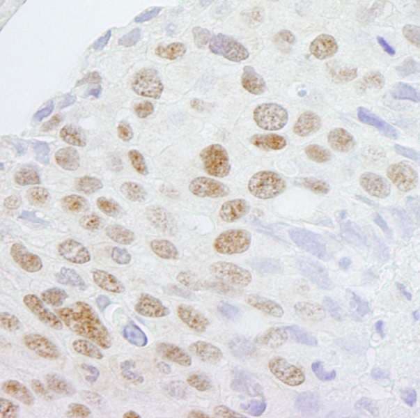 ZCCHC8 Antibody (aa1-50)