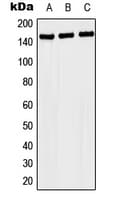 NACAD Antibody (Internal)