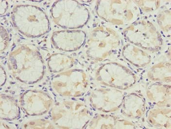 Polyclonal Rabbit anti-Human MYO5C Antibody (IHC)