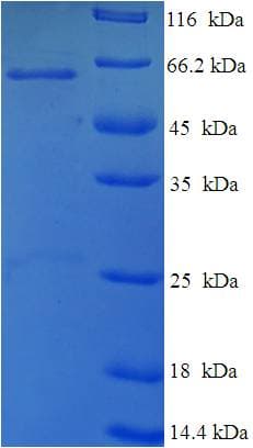 Mouse TP53 / p53 Protein (Recombinant His-SUMO)