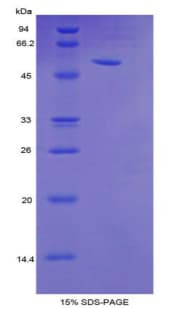 Mouse TFF3 / Trefoil Factor 3 Protein (Recombinant His-MBP)