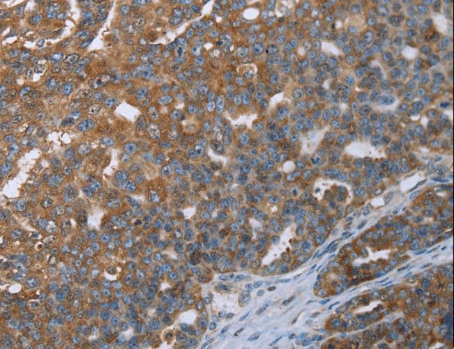LASS4 Antibody