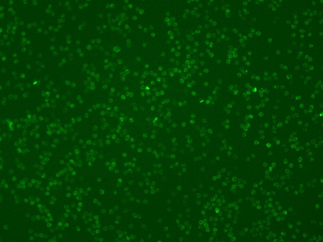 CARMA1 / CARD11 Antibody