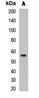 CBX4 Antibody