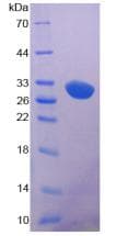 Rat LRP5 Protein (Recombinant His-S)