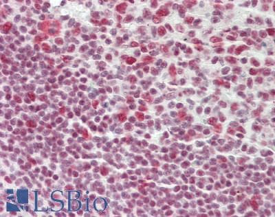 IHC-plus™ Monoclonal Mouse anti-Human TDP-43 / TARDBP Antibody (clone 3H8, IHC, IF, WB)