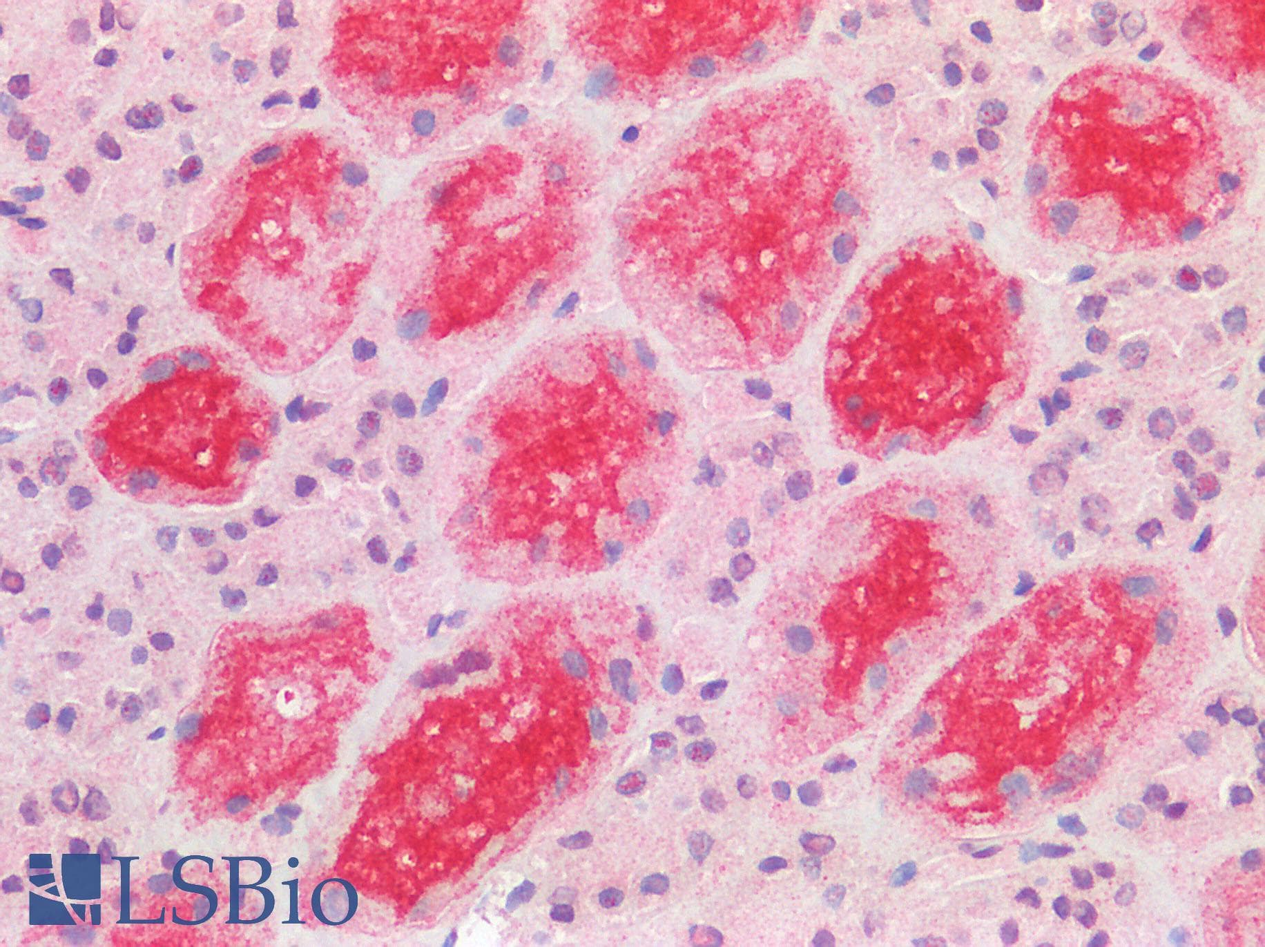 PathPlus™ ACE2 / ACE-2 Antibody