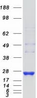 Human RAB8B Protein (Recombinant Myc-DDK (Flag))