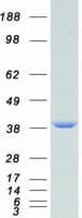 Human ANXA5 / Annexin V Protein (Recombinant Myc-DDK (Flag))