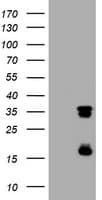 Monoclonal Mouse anti-Human TS / Thymidylate Synthase Antibody (clone OTI4G10, WB)