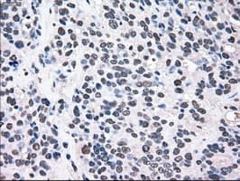 MAP2K2 / MKK2 / MEK2 Antibody (clone OTI8G6)