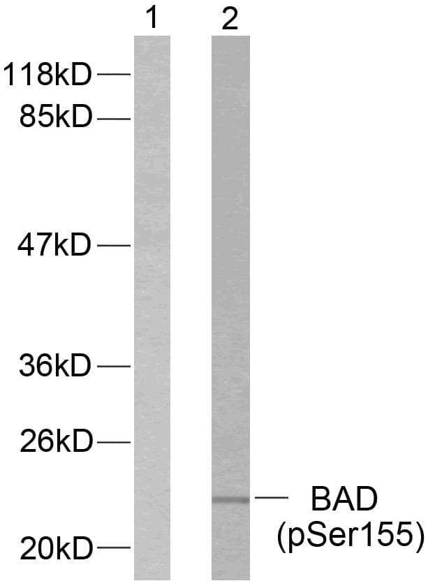 Polyclonal Rabbit anti-Human BAD Antibody (phospho-Ser155, IHC, WB)