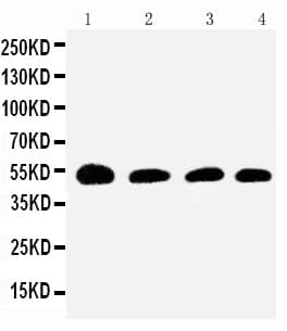 Antithrombin-III Antibody (aa93-107)