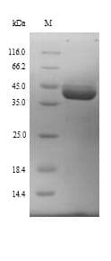 Mouse E6AP / UBE3A Protein (Recombinant 6His, N-terminus)