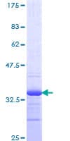 Human TMSB4X / Thymosin Beta-4 Protein (Recombinant GST)