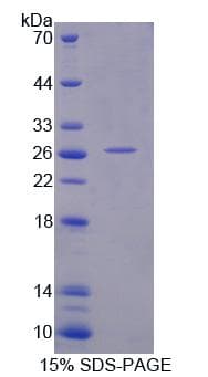 Human Junctin / ASPH Protein (Recombinant His-T7)