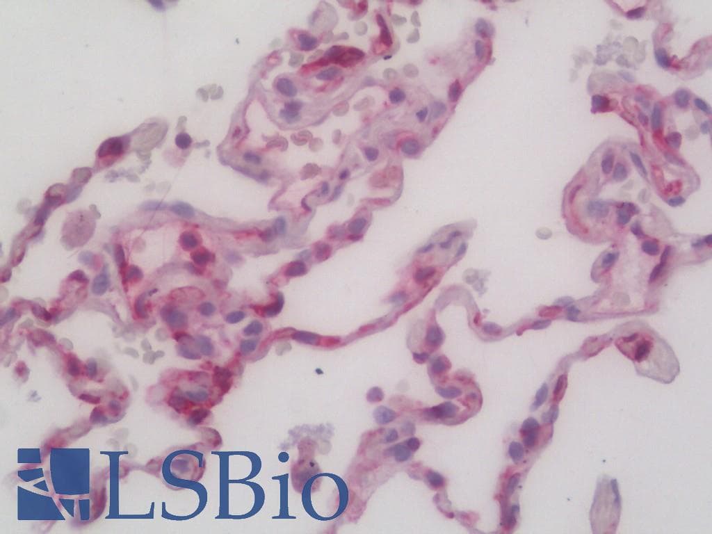 IHC-plus™ Monoclonal Mouse anti-Human HLA-E Antibody (clone MEM-E/02, Concentrated, IHC, WB)