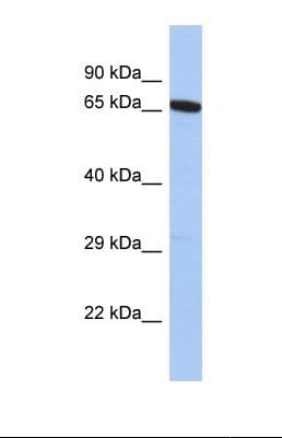 GALNT15 / GALNTL2 Antibody (aa21-70)