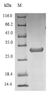 Human IL-1B / IL-1 Beta Protein (Recombinant 6His-SUMO, N-terminus)