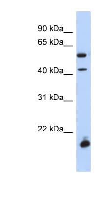 DBX1 Antibody (aa248-297)
