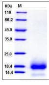 Human CD59 Protein (Recombinant His,C-terminus)