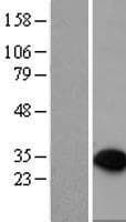 Human PTPRCAP / CD45 AP Protein (Over-Expression Lysate Myc-DDK (Flag))