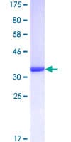 Human S100A8 / MRP8 Protein (Recombinant GST)