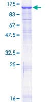 Human PLG / Plasmin / Plasminogen Protein (Recombinant GST)
