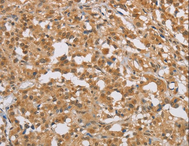 Polyclonal Rabbit anti-Human DIO1 / TXDI1 Antibody (IHC)
