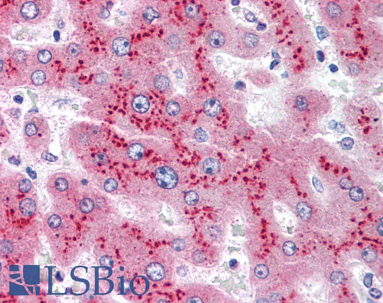 PathPlus™ SAA1 / SAA / Serum Amyloid A Antibody